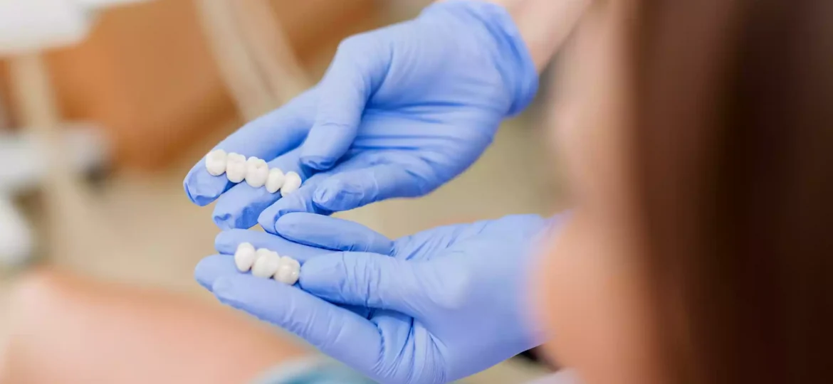 How Long Do Porcelain Veneers Last? A Comprehensive Guide