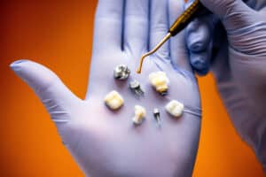 dental crown materials