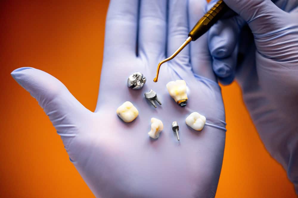 dental crown materials